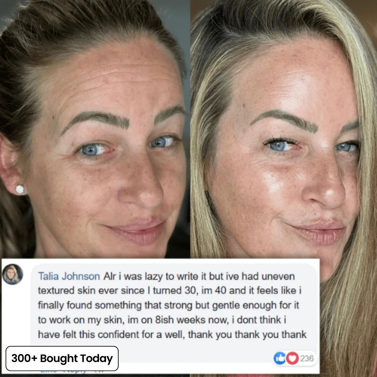 🔥LAST DAY 60% OFF Oralistlab Korean Pink Collagen Volume Multi Balm