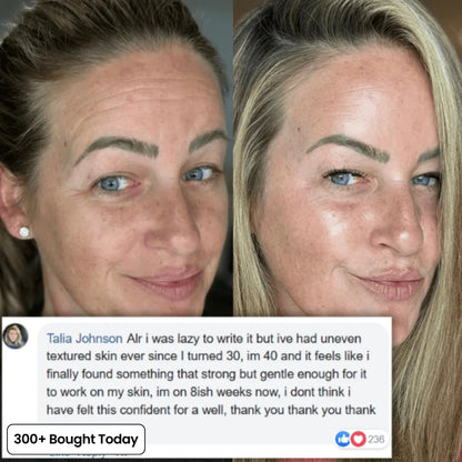 🔥LAST DAY 60% OFF Oralistlab Korean Pink Collagen Volume Multi Balm