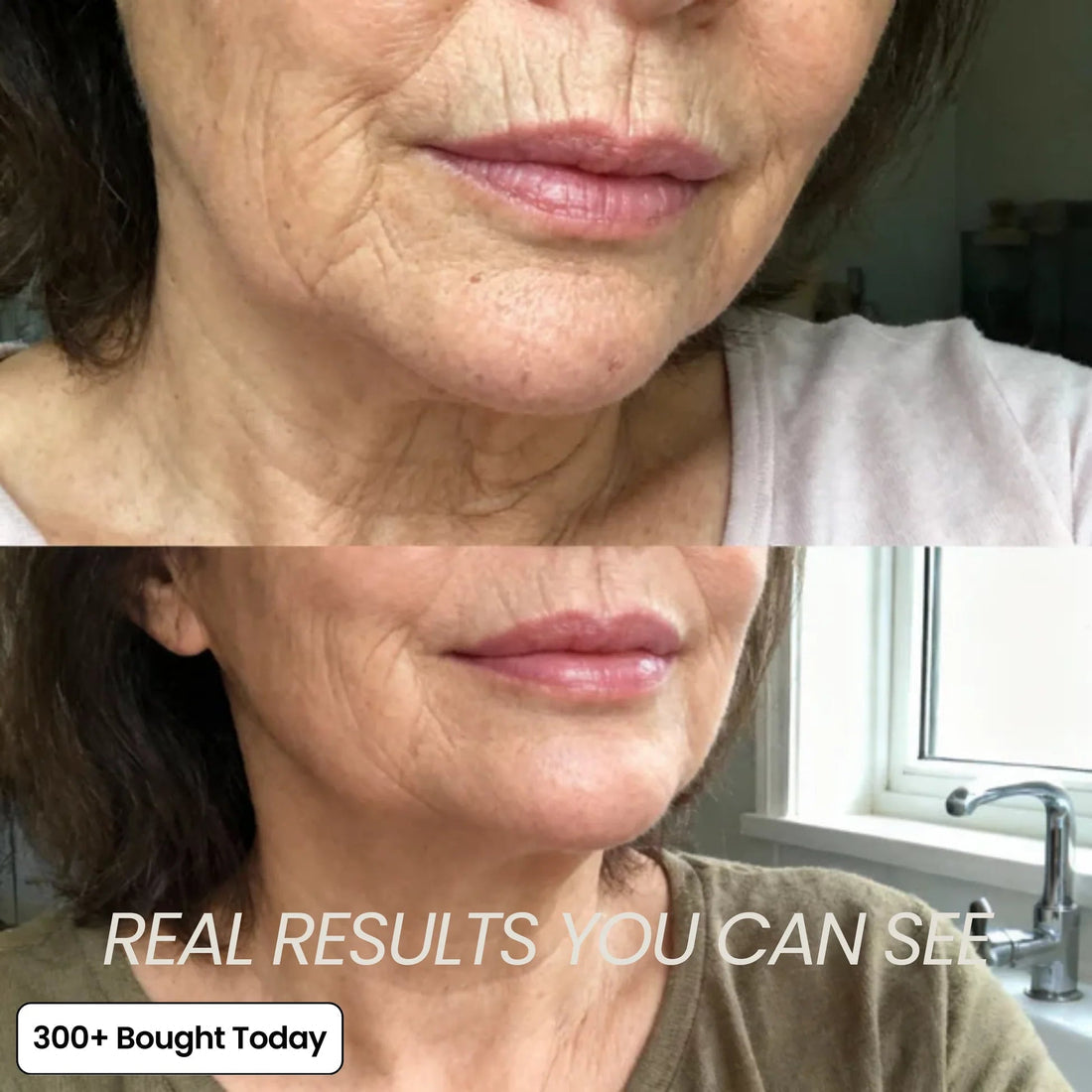 🔥LAST DAY 60% OFF Oralistlab Korean Pink Collagen Volume Multi Balm