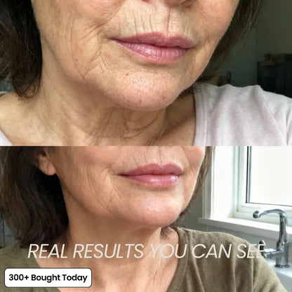 🔥LAST DAY 60% OFF Oralistlab Korean Pink Collagen Volume Multi Balm