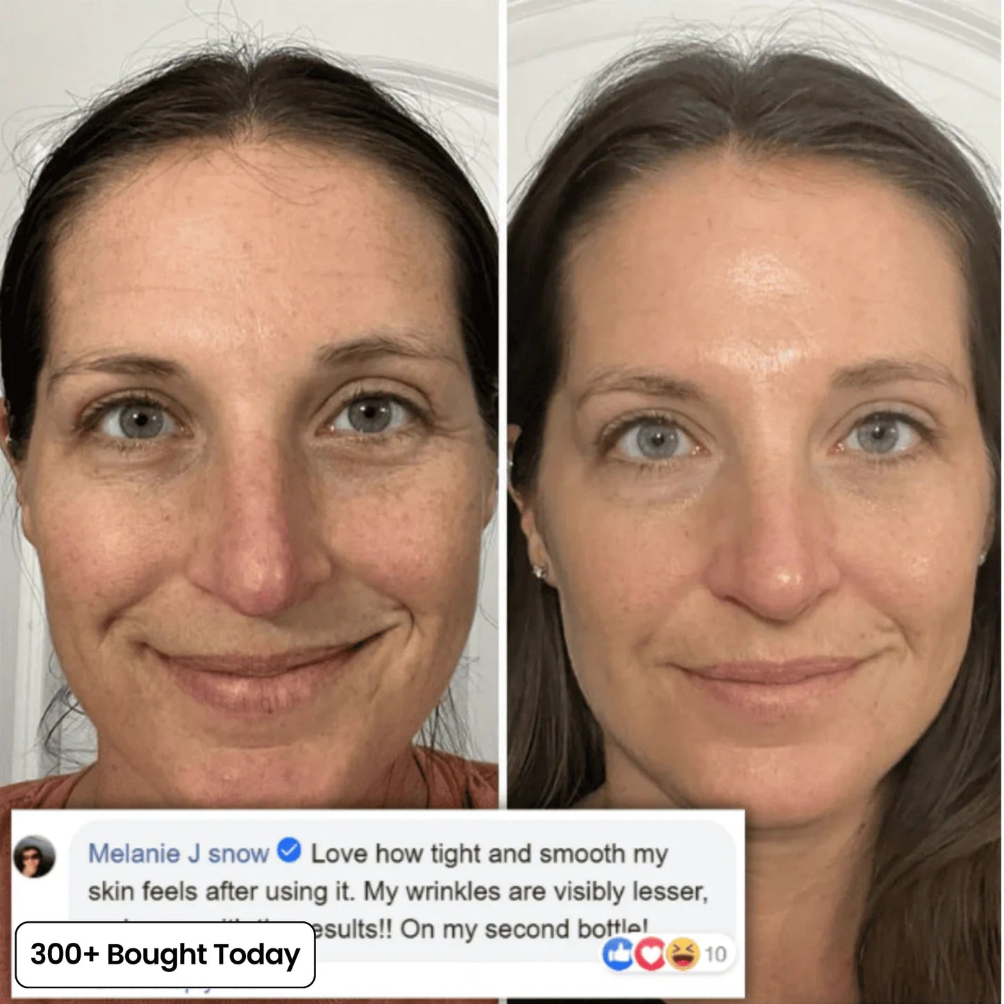 🔥LAST DAY 60% OFF Oralistlab Korean Pink Collagen Volume Multi Balm