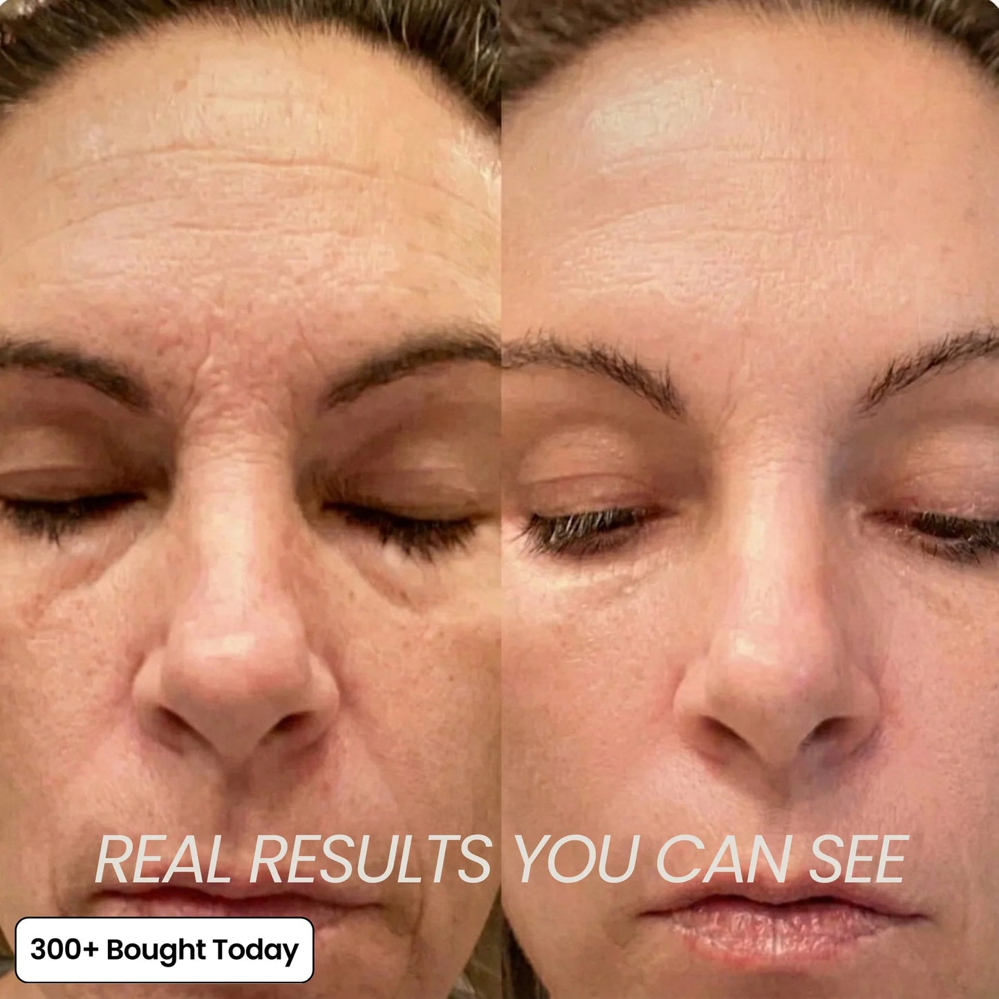 🔥LAST DAY 60% OFF Oralistlab Korean Pink Collagen Volume Multi Balm